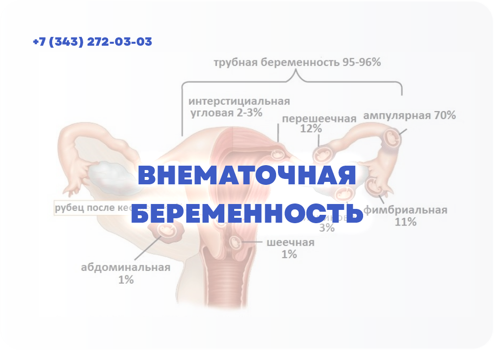 Варварство вернется